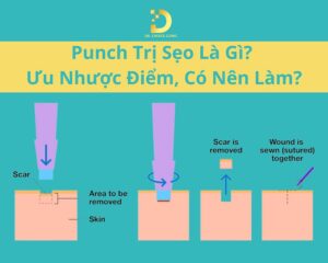 punch tri seo 1