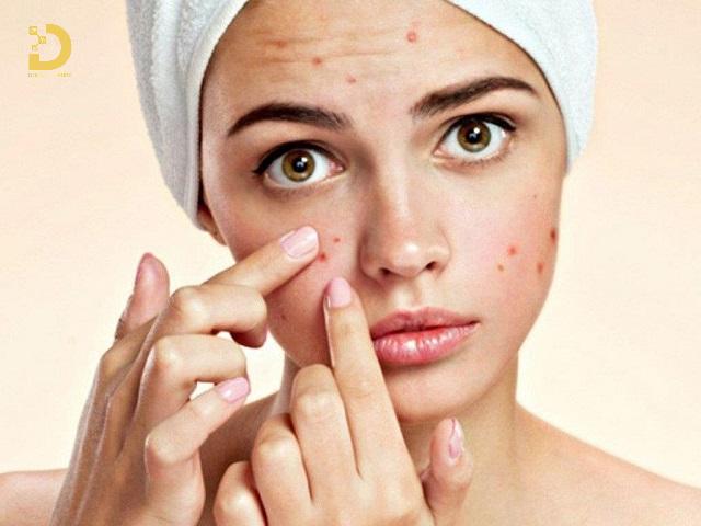 Sẹo Thâm: Nguyên Nhân Hình Thành, Cách Phòng Ngừa Và Điều Trị 9 seo tham la gi 3
