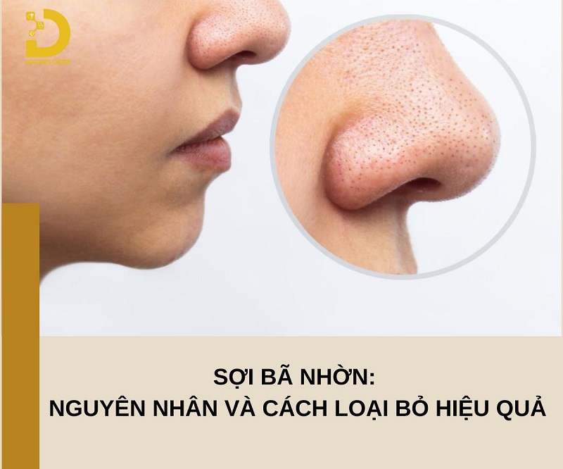 Sợi Bã Nhờn: Nguyên Nhân Và Cách Loại Bỏ Hiệu Quả 7 Sợi bã nhờn