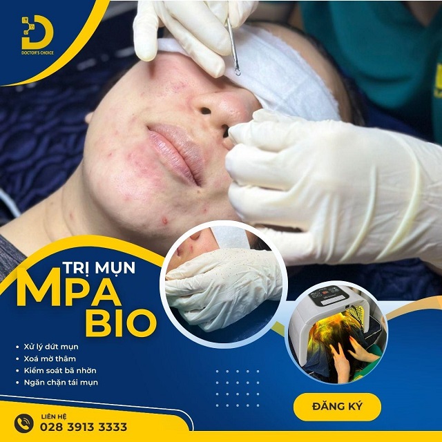 Sợi Bã Nhờn: Nguyên Nhân Và Cách Loại Bỏ Hiệu Quả 11 soi ba nhon 5