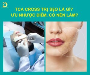 tca cross tri seo 1