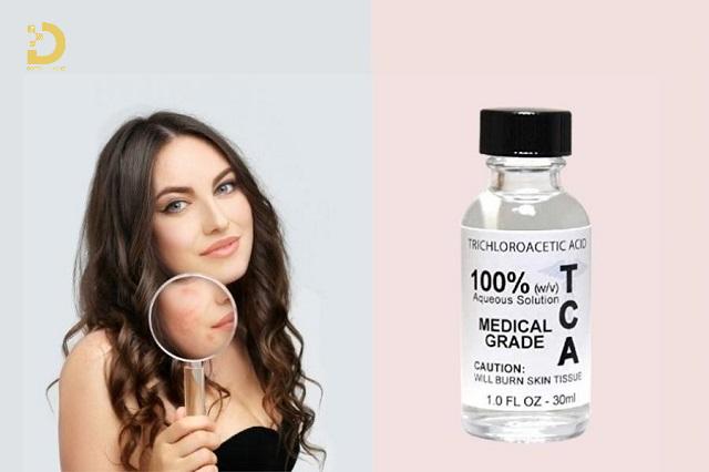 TCA Cross Trị Sẹo Là Gì? Ưu Nhược Điểm, Có Nên Làm? 10 TCA Cross trị sẹo là gì?