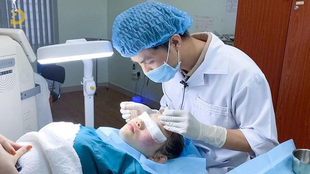 TCA Cross Trị Sẹo Là Gì? Ưu Nhược Điểm, Có Nên Làm? 13 tca cross tri seo 3