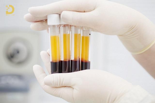 Trẻ Hóa Da Bằng PRP Là Gì? Ưu Nhược Điểm, Có Nên Làm? 10 tre hoa da bang prp 1