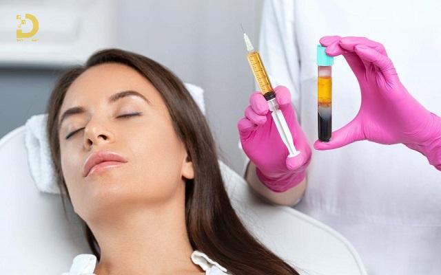 Trẻ Hóa Da Bằng PRP Là Gì? Ưu Nhược Điểm, Có Nên Làm? 12 tre hoa da bang prp 3