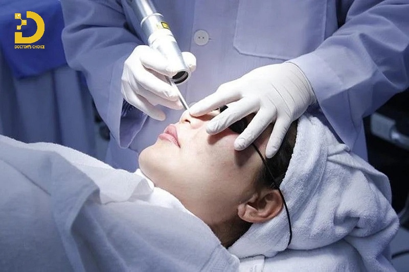 Top 9+ Phương Pháp Điều Trị Mụn Chuẩn Y Khoa Tốt Nhất 21 Trị mụn đầu đen bằng laser