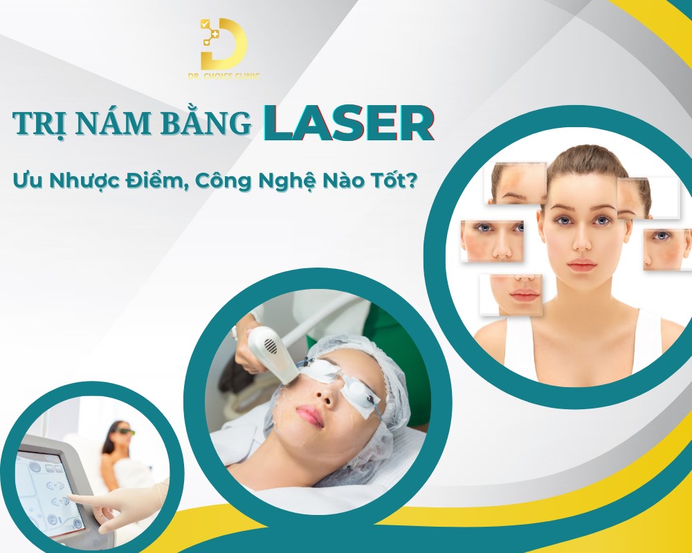 Trị Nám Bằng Laser: Ưu Nhược Điểm, Công Nghệ Nào Tốt? 9 Trị nám da bằng laser