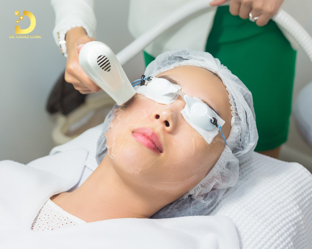 Trị Nám Bằng Laser: Ưu Nhược Điểm, Công Nghệ Nào Tốt? 10 Trị nám da bằng laser