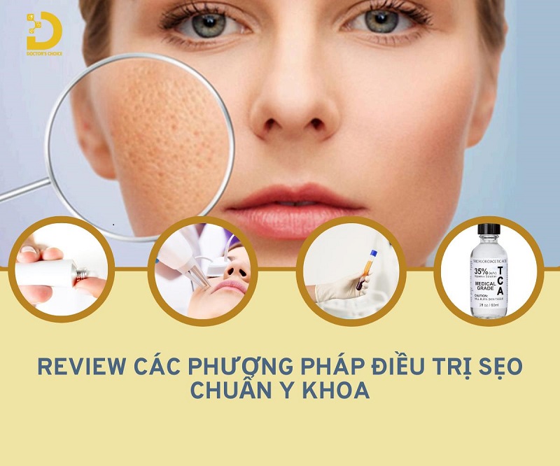 Review Các Phương Pháp Điều Trị Sẹo Chuẩn Y Khoa 15 tri seo chuan y khoa 1