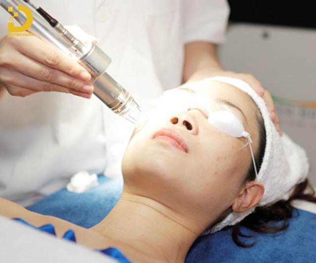 Review Các Phương Pháp Điều Trị Sẹo Chuẩn Y Khoa 17 tri seo chuan y khoa 3