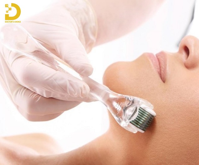 Review Các Phương Pháp Điều Trị Sẹo Chuẩn Y Khoa 18 tri seo chuan y khoa 4