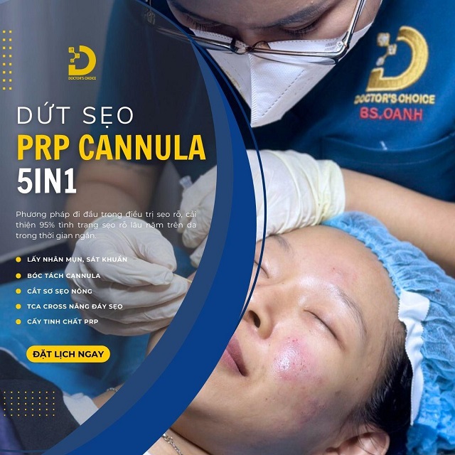 Review Các Phương Pháp Điều Trị Sẹo Chuẩn Y Khoa 20 tri seo chuan y khoa 6