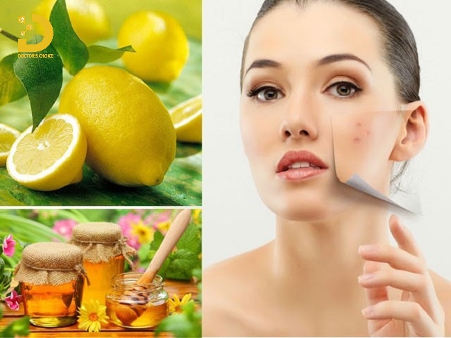 Thâm Da Do Đâu? Các Loại Thâm Da Thường Gặp Và Cách Điều Trị Hiệu Quả 14 Các nguyên liệu tự nhiên điều trị thâm da hiệu quả