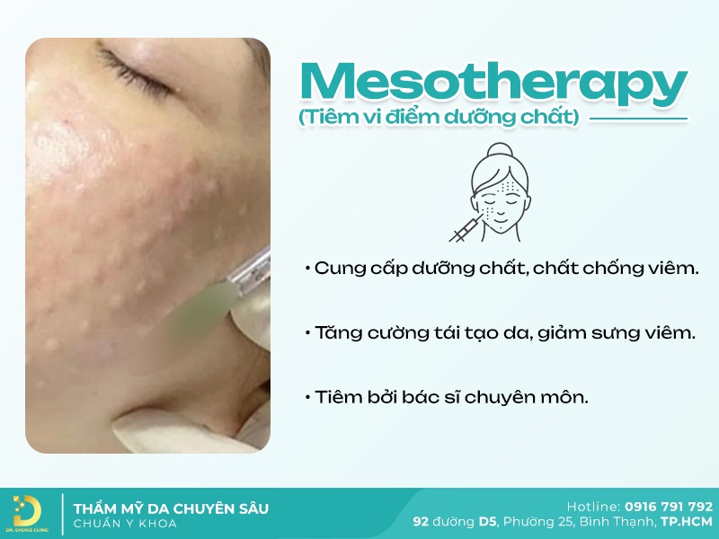 Phòng khám điều trị bớt sắc tố da tại TPHCM hiệu quả 31 Mesotherapy