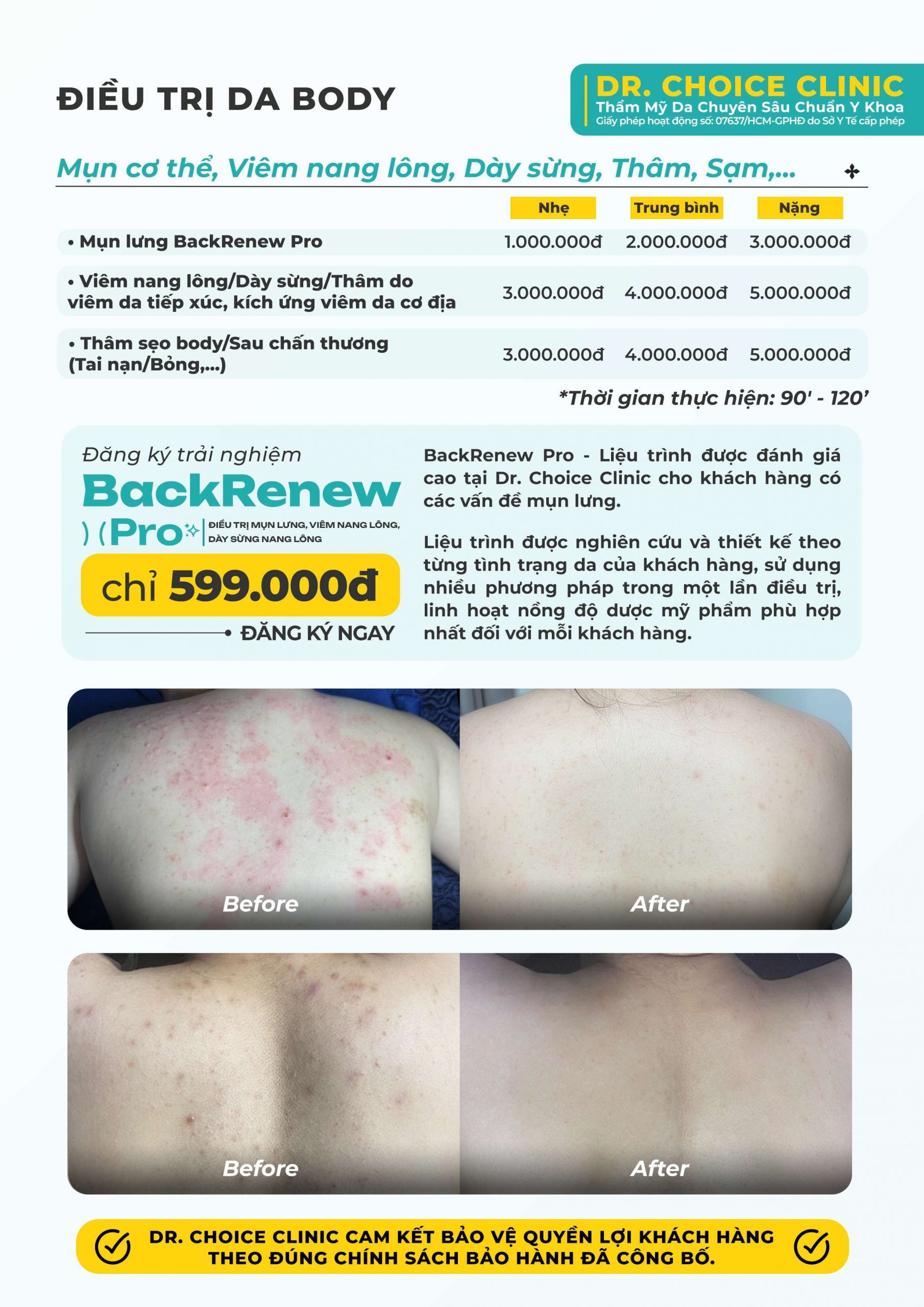 Dịch Vụ Chăm Sóc, Điều Trị, Thẩm Mỹ Da Chuẩn Y Khoa TP. HCM 66 Bảng giá