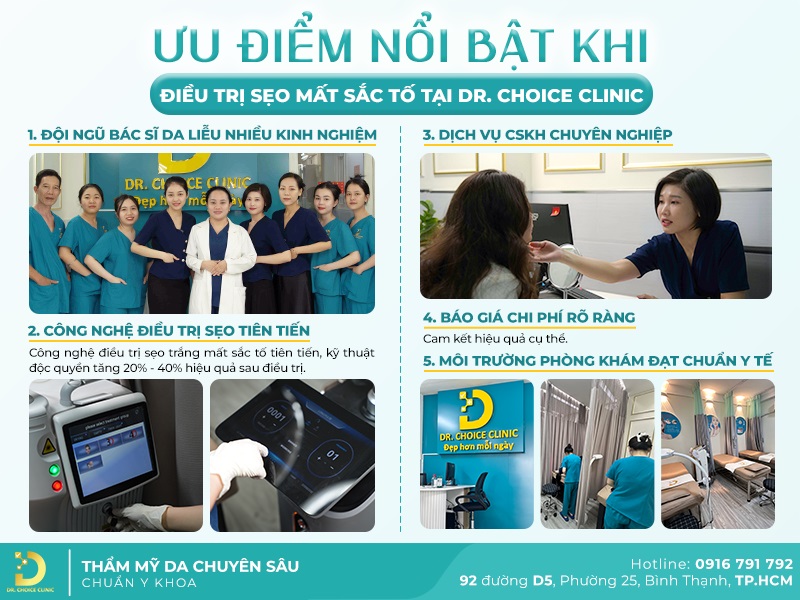 Phòng Khám Điều Trị Sẹo Mất Sắc Tố (Sẹo Trắng) Uy Tín Tại HCM 18 có nên điều trị sẹo trắng
