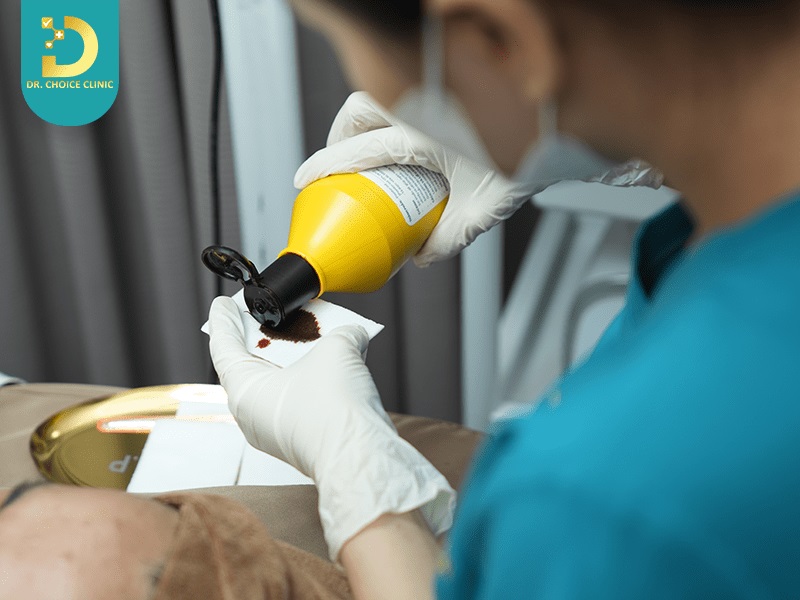 Phòng Khám Điều Trị Nám Má Hiệu Quả, An Toàn Ở HCM 25 cong nghe tri nam da hieu qua