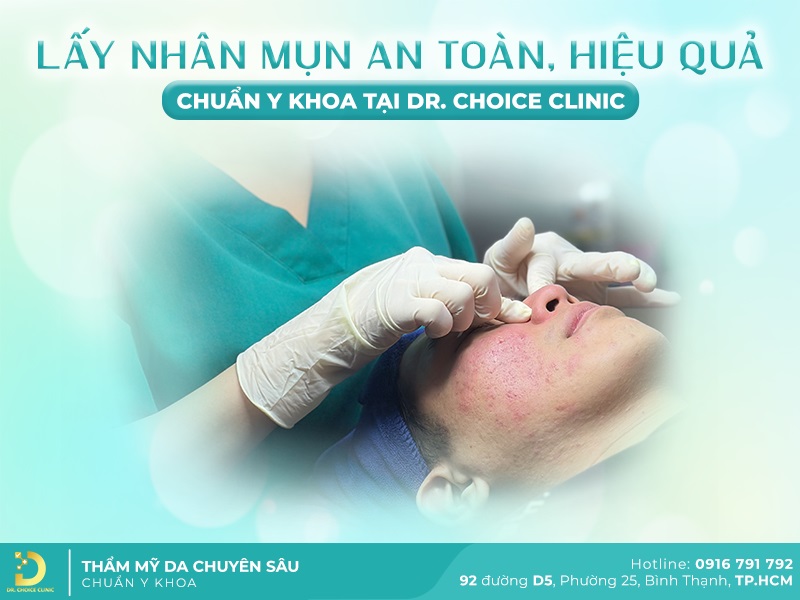 Lấy Nhân Mụn An Toàn, Hiệu Quả Chuẩn Y Khoa Tại TP.HCM 13 Dịch vụ lấy nhân mụn an toàn chuẩn y khoa