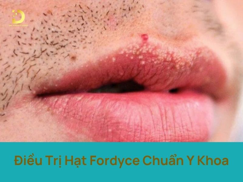Phòng Khám Điều Trị Hạt Fordyce Chuẩn Y Khoa Tại TPHCM 7 Điều trị hạt Fordyce chuẩn y khoa
