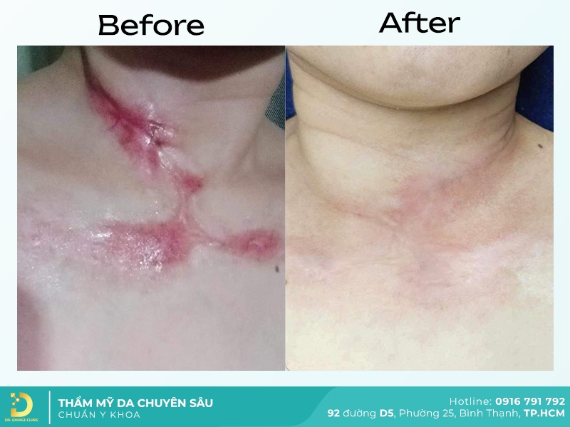Giới Thiệu Về Dr. Choice Clinic 21 dieu tri seo 1