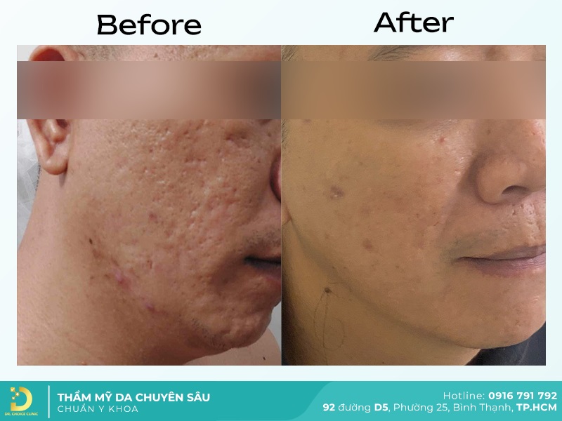 Giới Thiệu Về Dr. Choice Clinic 23 dieu tri seo 3