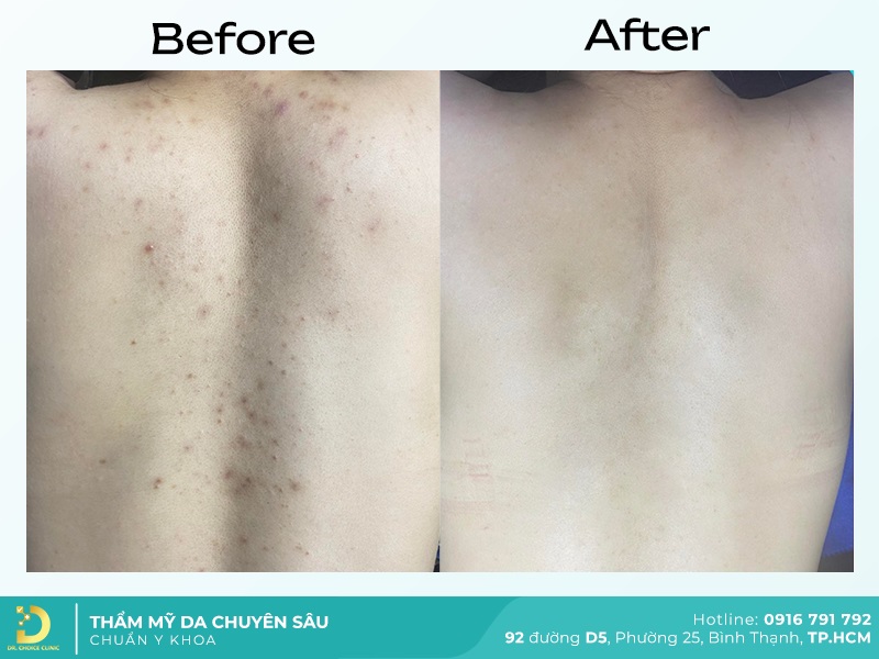 Giới Thiệu Về Dr. Choice Clinic 25 dieu tri tham 2