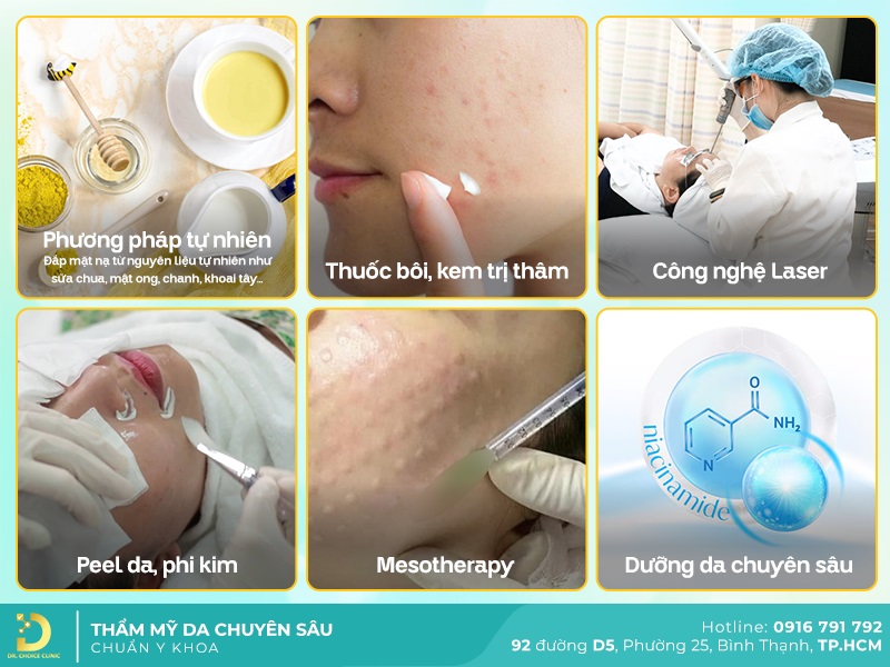 Phòng khám điều trị thâm mặt tại TPHCM chuẩn an toàn 11 Phương pháp điều trị thâm mặt