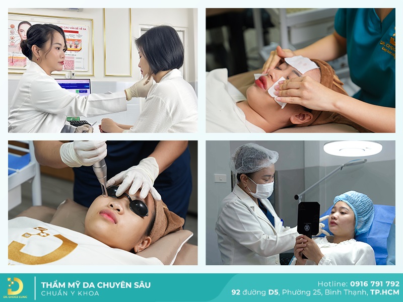 Phòng Khám Điều Trị Nám Má Hiệu Quả, An Toàn Ở HCM 28 lieu tri dieu tri nam tai dr choice clinic