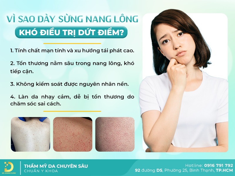 Phòng Khám Điều Trị Dày Sừng Nang Lông Hiệu Quả Tại TPHCM 9 Lý do dày sừng nang lông khó điều trị dứt điểm