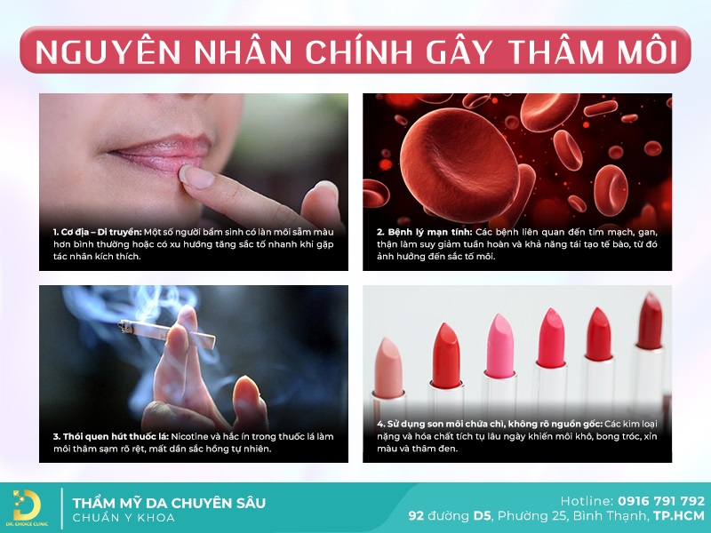 Phòng Khám Điều Trị Thâm Môi Tại HCM Đẹp Tự Nhiên 10 nguyên nhân gây thâm môi