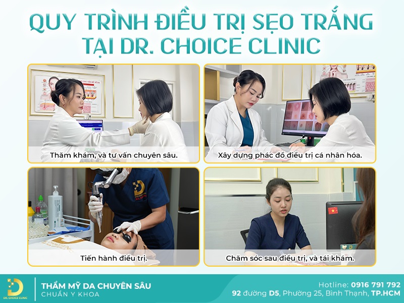 Phòng Khám Điều Trị Sẹo Mất Sắc Tố (Sẹo Trắng) Uy Tín Tại HCM 17 quy trình điều trị sẹo trắng