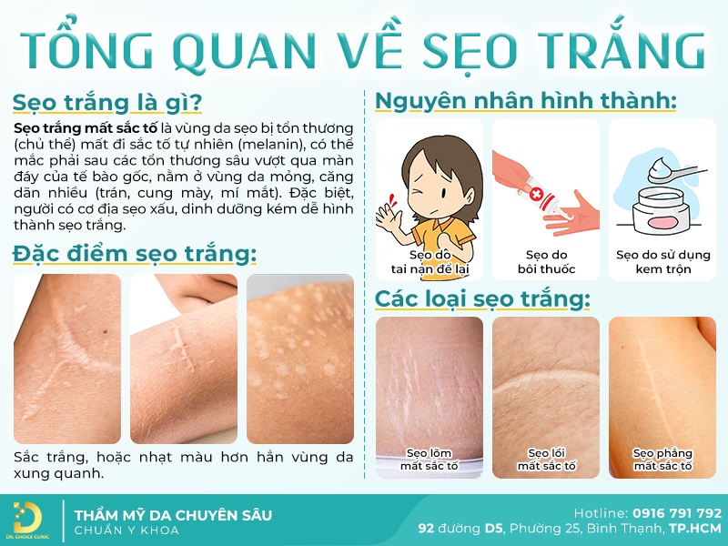 Phòng Khám Điều Trị Sẹo Mất Sắc Tố (Sẹo Trắng) Uy Tín Tại HCM 16 nguyên nhân gây nên sẹo trắng