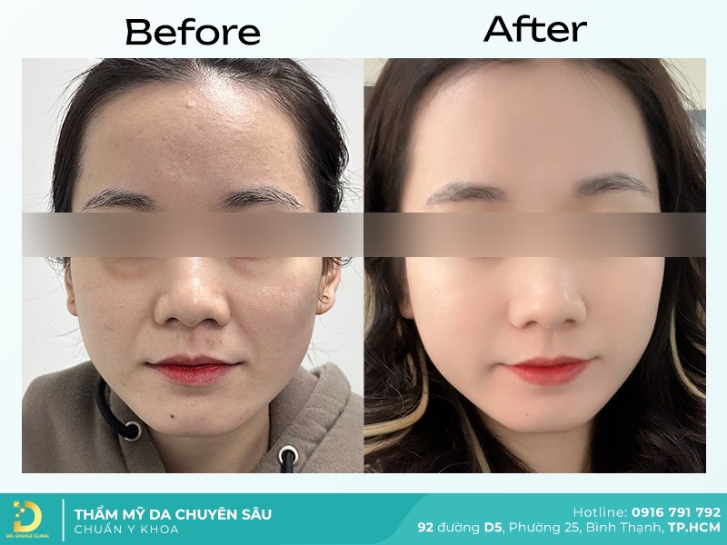 Giới Thiệu Về Dr. Choice Clinic 29 tre hoa da 1