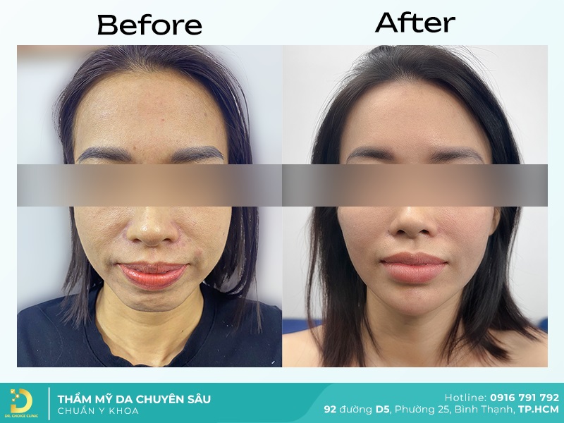 Giới Thiệu Về Dr. Choice Clinic 30 tre hoa da 2