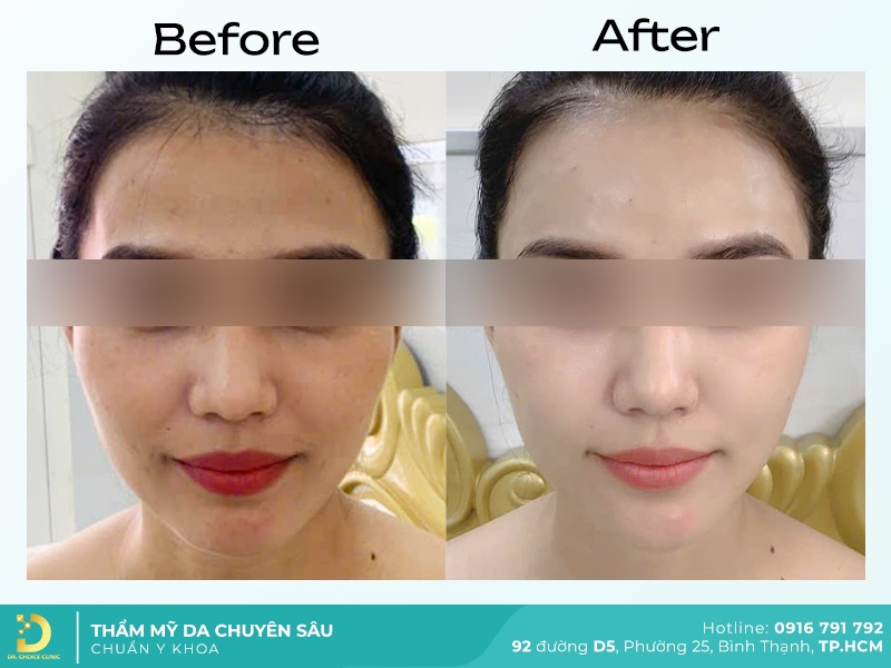 Giới Thiệu Về Dr. Choice Clinic 31 tre hoa da 3