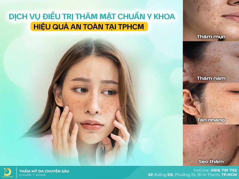 Phòng khám điều trị thâm mặt tại TPHCM chuẩn an toàn 9 trị thâm mặt