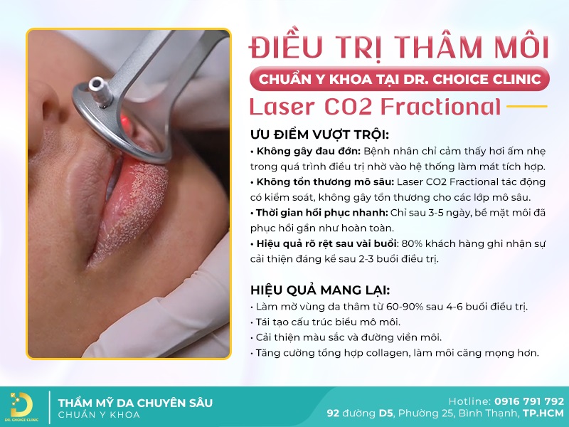 Phòng Khám Điều Trị Thâm Môi Tại HCM Đẹp Tự Nhiên 11 trị thâm môi bằng Laser CO2 Fractional