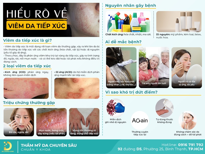 Phòng Khám Điều Trị Viêm Da Tiếp Xúc Hiệu Quả, An Toàn Tại TPHCM 8 Những vấn đề cần biết về viêm da tiếp xúc