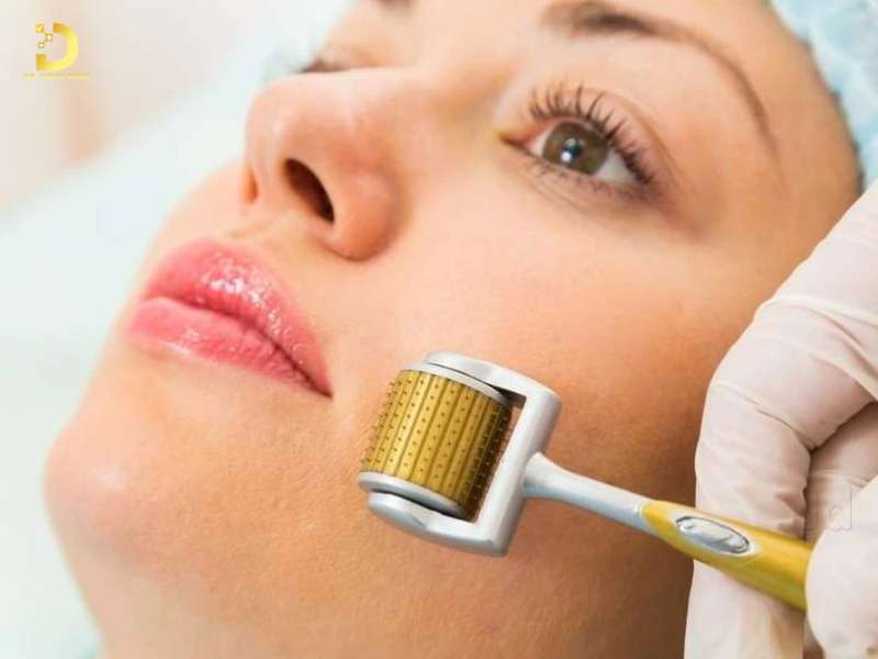 Sẹo Đáy Nhọn: Đặc Điểm, Nguyên Nhân & Cách Điều Trị Hiệu Quả 11 Nguyên tắc chăm sóc & điều trị sẹo đáy nhọn