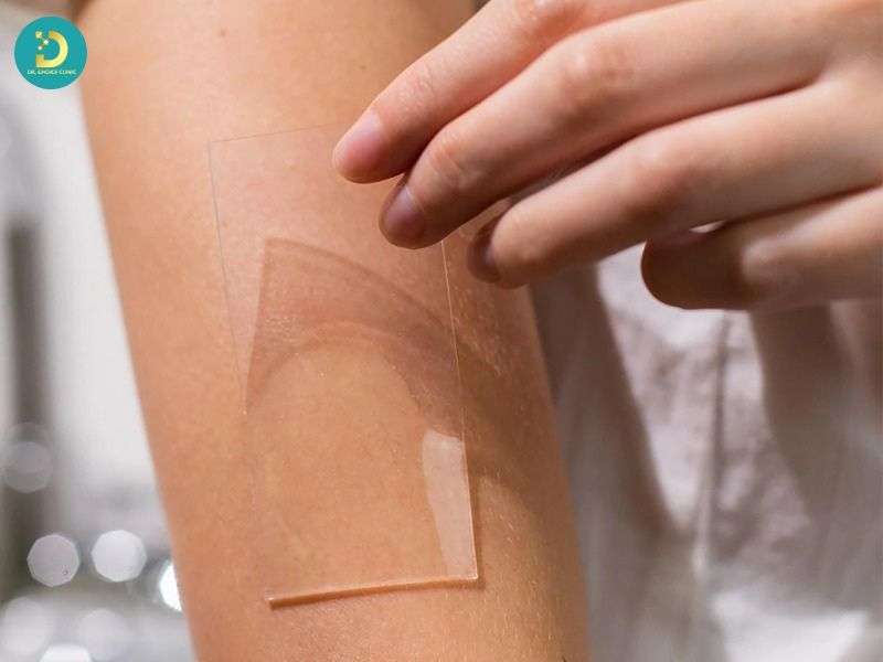 Sẹo Lồi Trắng: Nguyên Nhân & Cách Điều Trị Hiệu Quả 13 Chăm sóc da và giảm sức căng vùng sẹo