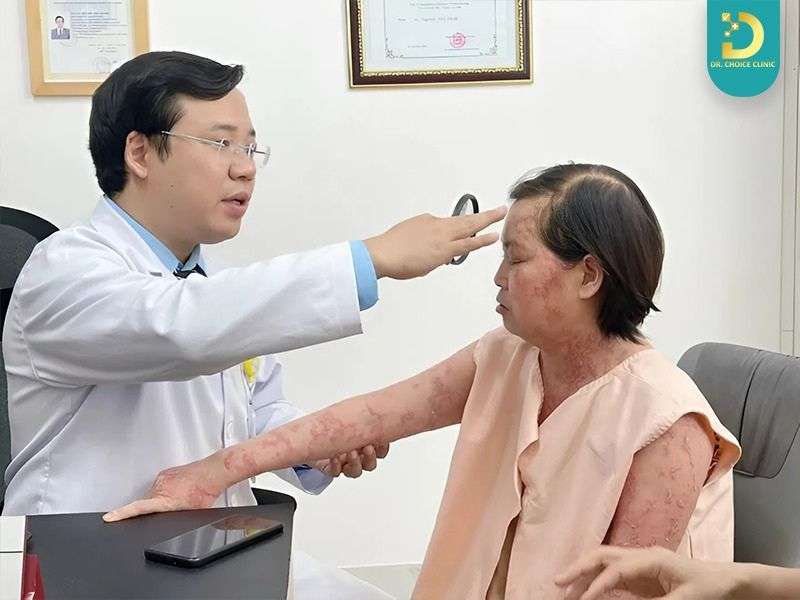 Vảy Nến Có Hết Không? Cách Chăm Sóc & Điều Trị Hiệu Quả Tại Nhà 19 Khi nào cần đi khám bác sĩ?
