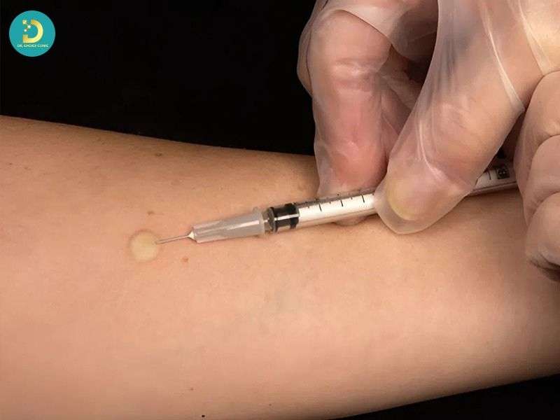 Sẹo Lồi Trắng: Nguyên Nhân & Cách Điều Trị Hiệu Quả 14 Những sai lầm cần tránh khiến sẹo nặng hơn