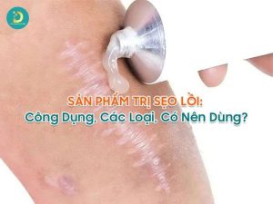 Sản phẩm trị sẹo lồi