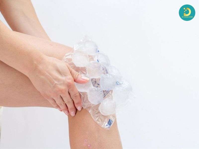 Nổi Mề Đay: Nguyên Nhân, Triệu Chứng & Cách Điều Trị Nhanh Chóng 15 Xử lý ban đầu và giảm ngứa nhanh tại nhà