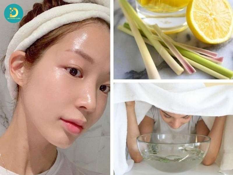 Xông Hơi Trị Mụn: Lợi Ích & Cách Thực Hiện Tại Nhà 17 Các loại nguyên liệu xông hơi trị mụn phổ biến và cách lựa chọn