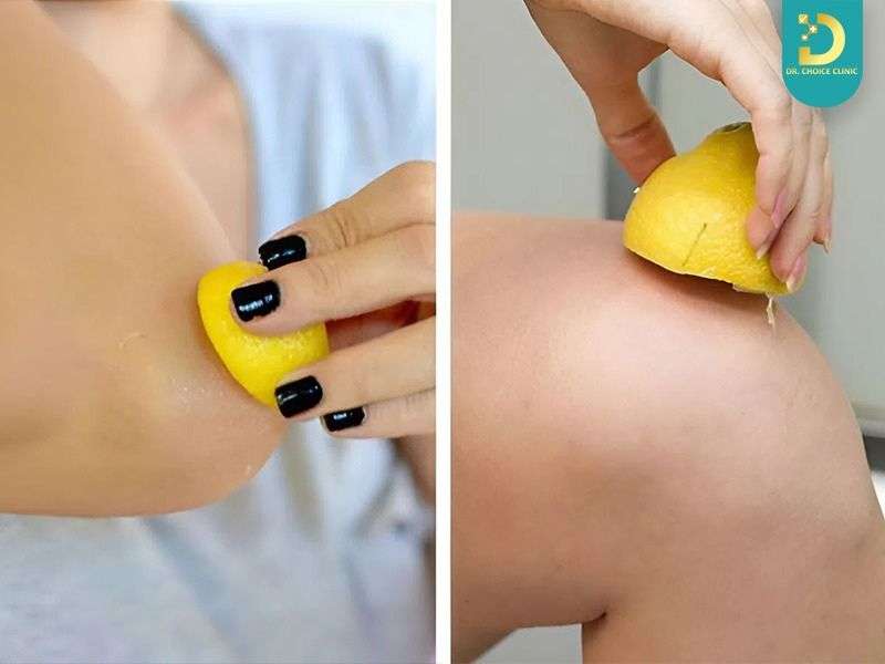 Top Cách Trị Thâm Đầu Gối, Khuỷu Tay, Mắt Cá Hiệu Quả Tại Nhà 17 Chà xát, kỳ cọ quá mạnh khiến da thâm nặng hơn