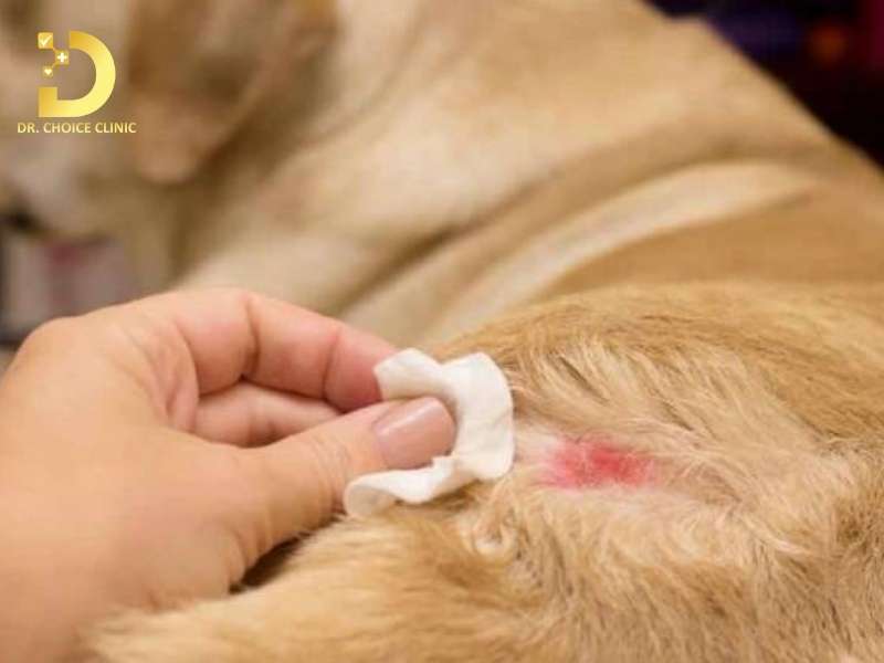 Nấm Thân Mình: Triệu Chứng, Nguyên Nhân & Cách Điều Trị Hiệu Quả 13 Chăm sóc và ngăn ngừa tái phát nấm thân mình như thế nào cho hiệu quả?