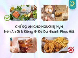 Chế độ ăn cho người bị mụn