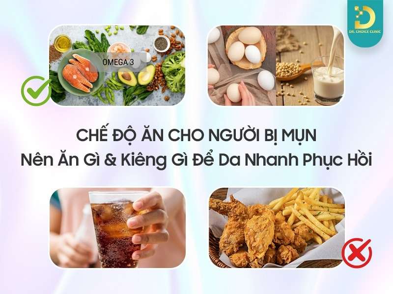 Chế Độ Ăn Cho Người Bị Mụn: Nên Ăn Gì & Kiêng Gì Để Da Nhanh Phục Hồi? 14 Chế độ ăn cho người bị mụn