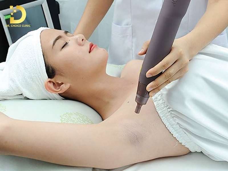 Thâm Nách: Nguyên Nhân Và Cách Điều Trị Hiệu Quả 11 Đâu là cách trị thâm nách hiệu quả?